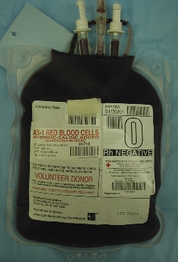 Understanding Shock V: Blood Transfusion
