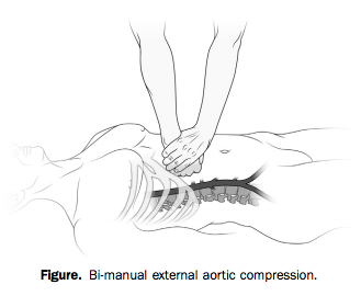 Manual aortic pressure